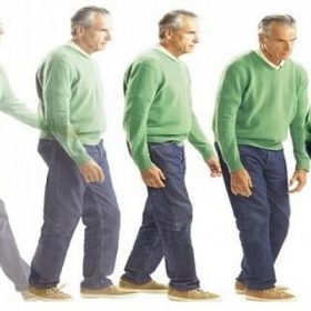 Biến chứng bệnh parkinson là gì? Có nguy hiểm không?