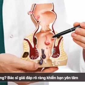 Có nên đi cắt trĩ không? Bác sĩ giải đáp rõ ràng khiến bạn yên tâm