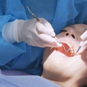 Top 5 cơ sở niềng răng uy tín tại TP Hồ Chí Minh